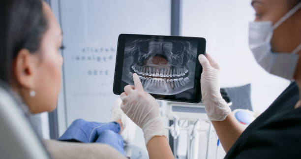 Licensed Dental Implants service in Mount Pleasant, TX - Smile Center Dentistry